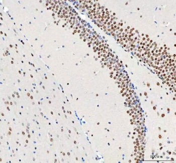 IHC staining of FFPE mouse brain tissue with DDX1 antibody. HIER: boil tissue sections in pH8 EDTA f