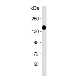 Glycogen debranching enzyme Antibody / AGL