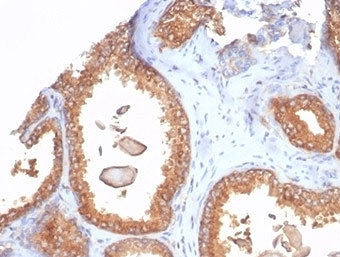 IHC staining of FFPE human prostate tissue with recombinant Beta-2 Microglobulin antibody (clone rB2