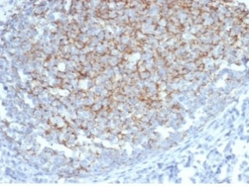 IHC staining of FFPE human tonsil tissue with Interferon alpha 1 antibody (clone IFNA/6689) at 2ug/m