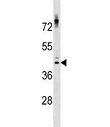 NKX2.1 Antibody