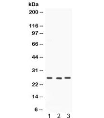 SIP Antibody / SIAH Interacting Protein