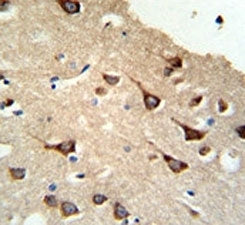 FYN Antibody