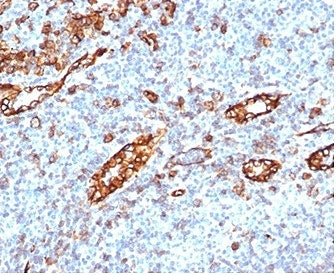 IHC staining of FFPE human tonsil tissue with recombinant PECAM-1 antibody (clone C31/6446R). HIER: 