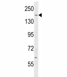 IQGAP2 Antibody