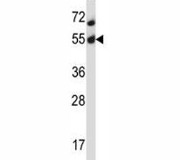 Akt2 Antibody