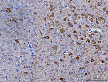 IHC staining of FFPE rat brain tissue with Neuromedin-S antibody. HIER: boil tissue sections in pH8 