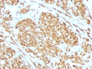 MART-1 / Melan-A Antibody