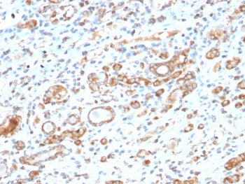 HSP60 Antibody