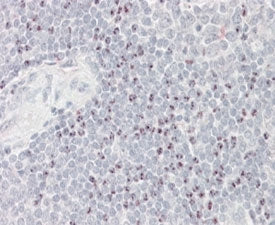 IHC testing of FFPE human spleen (nucleoli staining) with BAT3 antibody at 4ug/ml. HIER: steamed wit