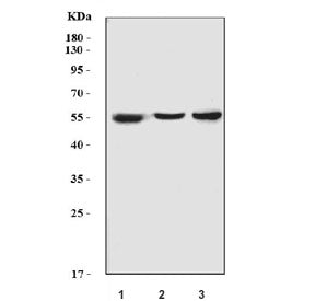 CYP2E1 Antibody / Cytochrome P450 2E1