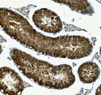 IFT88 Antibody