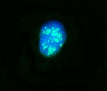 Immunofluorescent staining of FFPE human Caco-2 cells with NOP58 antibody (green) and DAPI nuclear s
