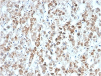 IL-25 Antibody / IL-17E