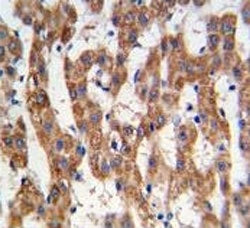 Prohibitin Antibody (PHB1)