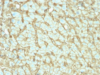 Albumin Antibody / ALB