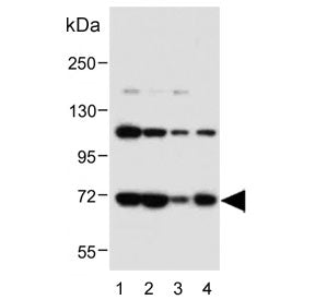 SMPD1 Antibody / Acid Sphingomyelinase