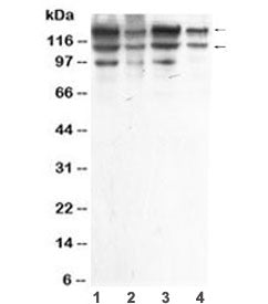 Western blot testing of human 1) HeLa, 2) A549, 3) MCF7 and 4) HepG2 cell lysate with ADAR1 antibody