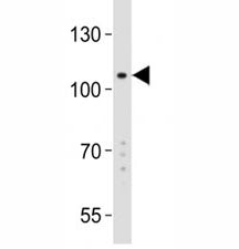 LGR5 Antibody (GPR49)