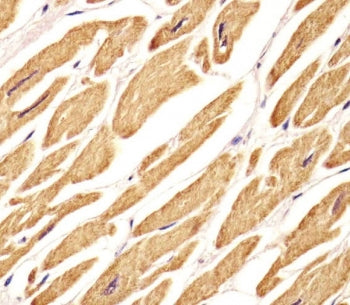 VLDLR Antibody / VLDL Receptor