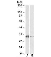 Western blot testing of human liver [A] and peripheral blood lymphocyte [B] lysates with GSTO1 antib