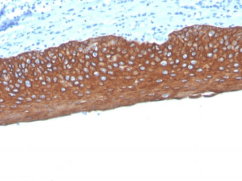 IHC staining of FFPE human tonsil tissue with Pan Cytokeratin antibody (clone MonoPoly/4999R). HIER: