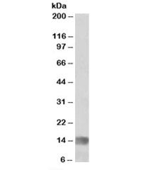 MIA Antibody