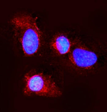 Claudin 3 Antibody / CLDN3