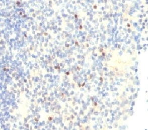 FOXP3 Antibody / Scurfin