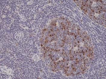 Aurora B Antibody / AURKB
