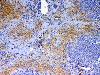 IHC testing of FFPE mouse spleen tissue with Cd40l antibody at 1ug/ml. Required HIER: steam section 