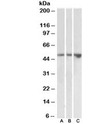 Western blot testing of kidney [A], testis [B] and uterus [C] lysates with KIM-1 antibody at 2ug/ml.
