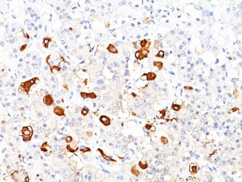 IHC staining of FFPE human pituitary with TSHB antibody (clone TSHb/1317). HIER: boil tissue section