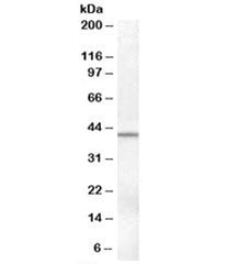 SERPINB6 Antibody