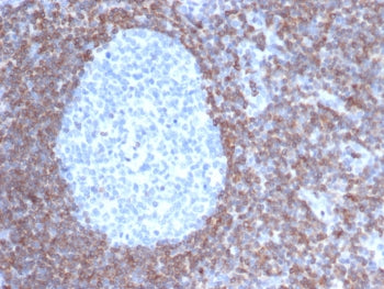 IHC staining of FFPE human tonsil tissue with Bcl-2 antibody (clone BCL2/6915). HIER: boil tissue se