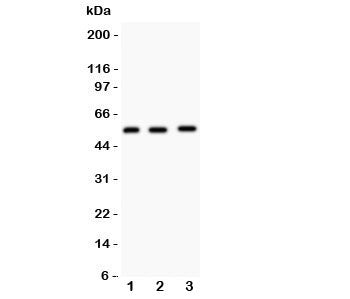 MMP14 Antibody