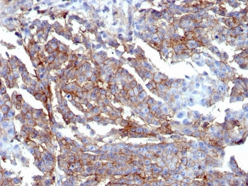 IHC staining of FFPE human breast tissue with recombinant CD44 antibody (clone HCAM/6459R). HIER: bo