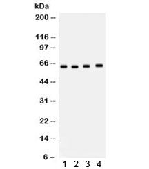 Western blot testing of 1) rat brain, 2) human Jurkat, 3) MM231 and 4) HT1080 lysate with CDC6 antib