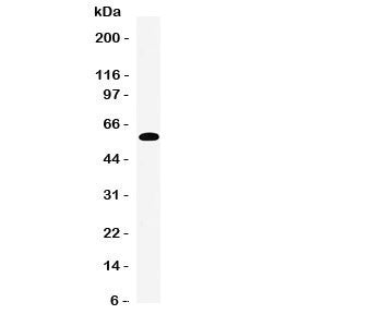 Western blot testing of EAAT3 antibody and human placenta tissue lysate. Expected molecular weight: 