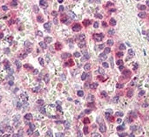 MMP9 Antibody