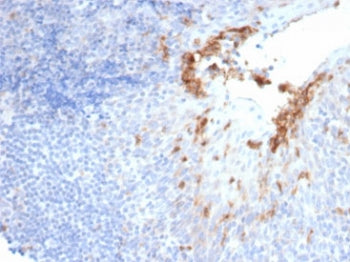 CD10 Antibody / Neprilysin