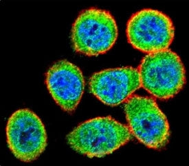 Confocal immunofluorescent analysis of IKK beta antibody with HeLa cells followed by Alexa Fluor 488