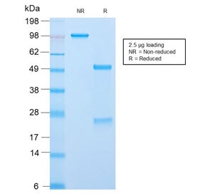 SDS-PAGE analysis of purified, BSA-free recombinant CLIP antibody (clone CLIP/2859R) as confirmation