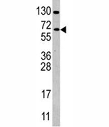 CDC25B Antibody