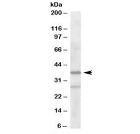 ARPC1B Antibody