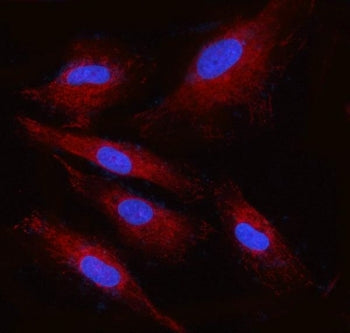 Immunofluorescent staining of FFPE human U-87 MG cells with Ribophorin II antibody (red) and DAPI nu