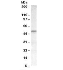 Western blot testing of human cerebellum lysate with CHRNB3 antibody at 1ug/ml. Predicted molecular 