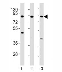 Western blot testing of IKKb antibody at 1:4000 dilution. Lane 1: HL-60 lysate; 2: HeLa lysate; 3: J