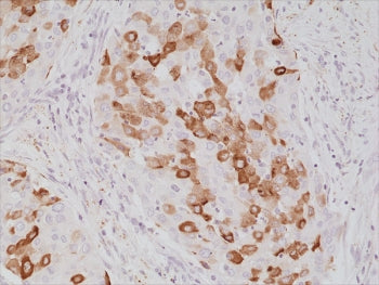 Recombinant Surfactant protein A Antibody / SFTPA1