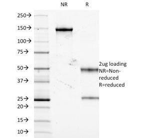 SDS-PAGE Analysis of Purified, BSA-Free TNF-alpha Antibody (clone J2D10). Confirmation of Integrity 
